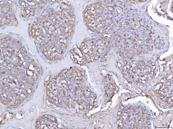 Anti-Pleckstrin/PLEK Antibody