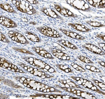 Anti-MUC5B Antibody