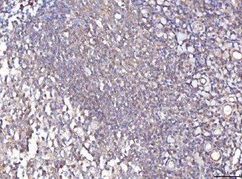 Anti-TTC11/FIS1 Antibody