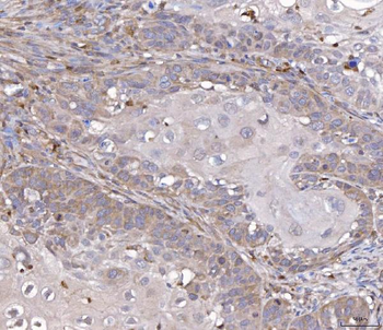 Anti-TTC11/FIS1 Antibody