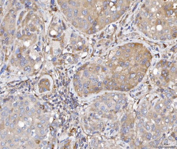 Anti-TTC11/FIS1 Antibody