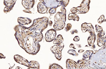 Anti-TTC11/FIS1 Antibody