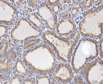 Anti-TTC11/FIS1 Antibody