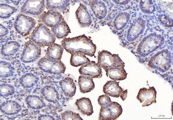 Anti-TTC11/FIS1 Antibody