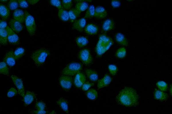 Anti-Eph receptor A3/EPHA3 Antibody