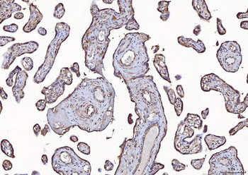 Anti-Eph receptor A3/EPHA3 Antibody