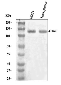 Anti-Eph receptor A3/EPHA3 Antibody