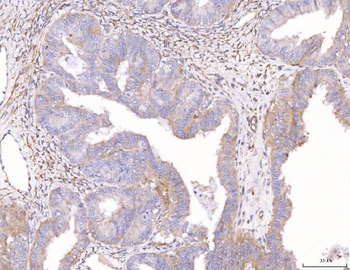 Anti-ENPP1/PC1 Antibody