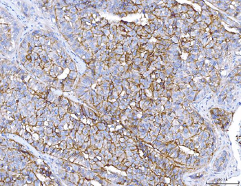 Anti-ENPP1/PC1 Antibody