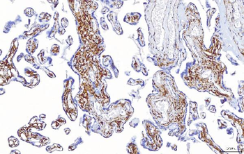 Anti-ENPP1/PC1 Antibody