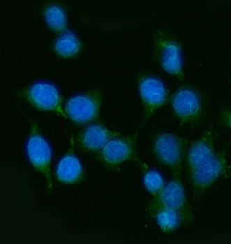Anti-PP11/ENDOU Antibody