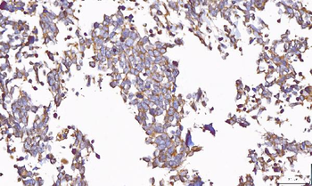 Anti-PP11/ENDOU Antibody
