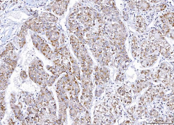 Anti-E2F3 Antibody