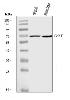 Anti-Choline Acetyltransferase/CHAT Antibody