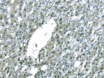 Anti-CD101 Antibody