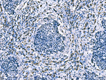 Anti-CD101 Antibody
