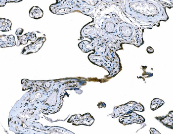 Anti-CD101 Antibody