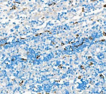 Anti-CD68 Antibody