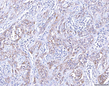 CCR7 Antibody