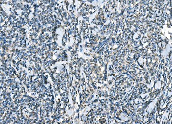 Anti-CCR2 Antibody