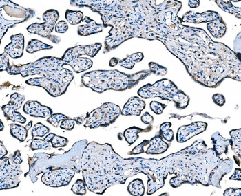 Anti-CCR2 Antibody