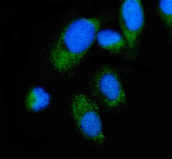 Anti-ALAS2/ASB Antibody