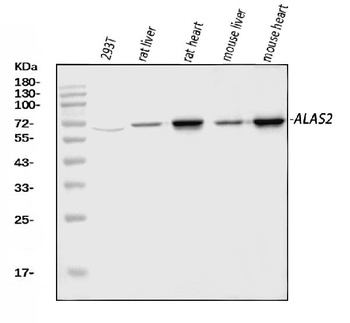 ALAS2/ASB Antibody