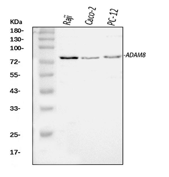 Anti-MS2/ADAM8 Antibody