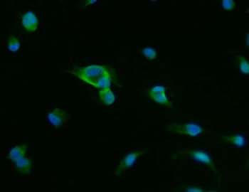 Anti-PAP/ACP3 Antibody