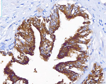 Anti-PAP/ACP3 Antibody