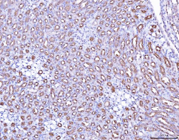 Anti-PAP/ACP3 Antibody