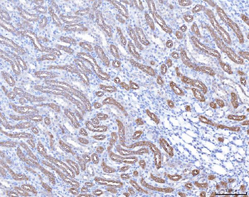 Anti-PAP/ACP3 Antibody