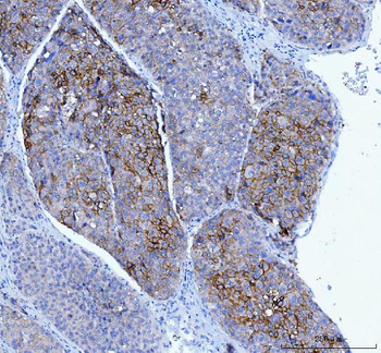 Anti-Poliovirus Receptor/PVR Antibody (monoclonal, 3B11E9)