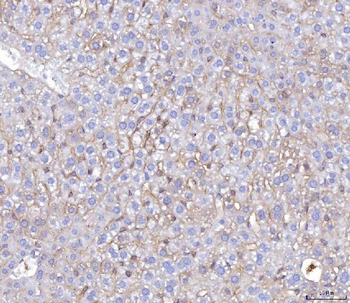 Anti-Poliovirus Receptor/PVR Antibody (monoclonal, 3B11E9)