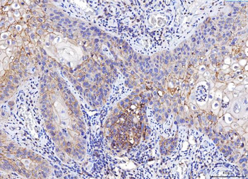 Anti-Poliovirus Receptor/PVR Antibody (monoclonal, 5I13D1)
