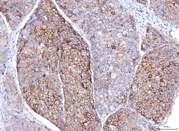 Anti-Poliovirus Receptor/PVR Antibody (monoclonal, 5I13D1)