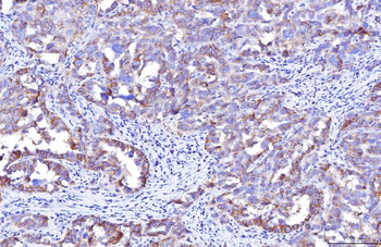 Anti-Poliovirus Receptor/PVR Antibody (monoclonal, 5I13D1)