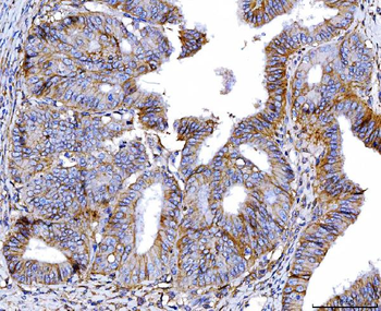 Anti-Poliovirus Receptor/PVR Antibody (monoclonal, 9B9F1)