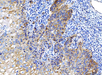 Anti-Poliovirus Receptor/PVR Antibody (monoclonal, 9B9F1)
