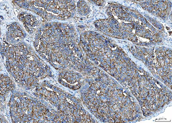 Anti-Poliovirus Receptor/PVR Antibody (monoclonal, 9B9F1)
