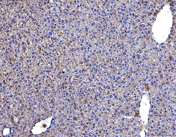 Anti-Poliovirus Receptor/PVR Antibody (monoclonal, 9B9F1)