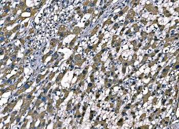 Anti-SOD2 Antibody (monoclonal, 2B12B1)