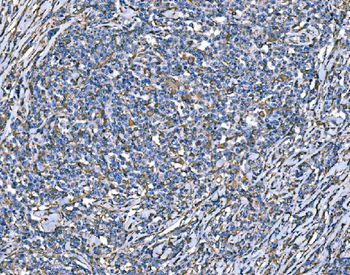 Anti-SOD2 Antibody (monoclonal, 2B12B1)
