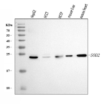 Anti-SOD2 Antibody (monoclonal, 2B12B1)