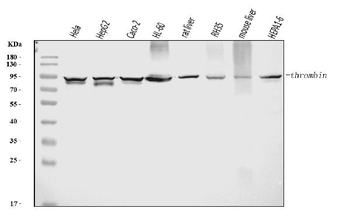 Prothrombin Antibody (monoclonal, 5B6G1)