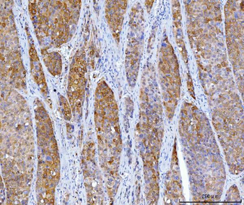 Anti-HGD Antibody (monoclonal, 2F11E1)