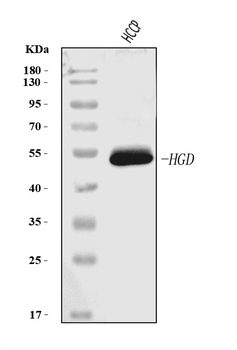 Anti-HGD Antibody (monoclonal, 2F11E1)