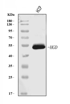 HGD Antibody (monoclonal, 2F11E1)