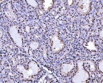 PC4/SUB1 Antibody (monoclonal, 6B5B10)