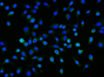 Anti-Neuropilin 1 Antibody (monoclonal, 8G6G7)